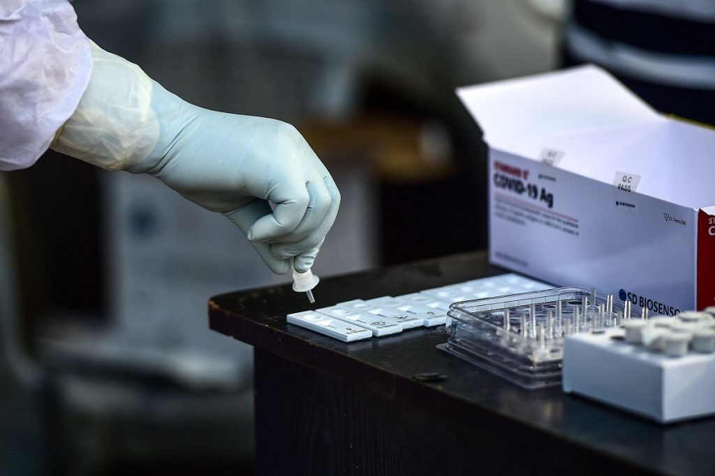 Σε 2 σημεία γίνονται σήμερα 22/3 δωρεάν rapid tests από τον ΕΟΔΥ