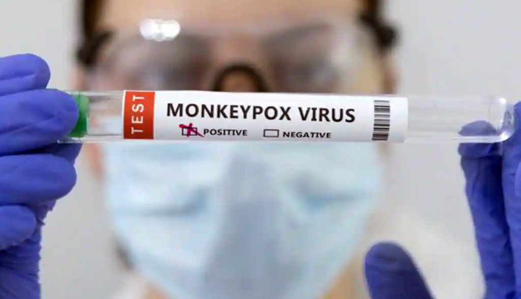 Ευλογιά των πιθήκων | Συνολικά 50 τα επιβεβαιωμένα κρούσματα στην Ελλάδα