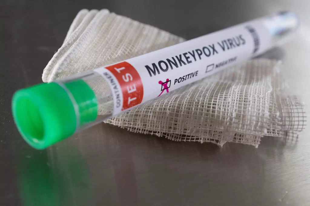 Ευλογιά των πιθήκων | Το πρώτο κρούσμα στην Ελλάδα